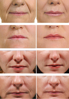 lips